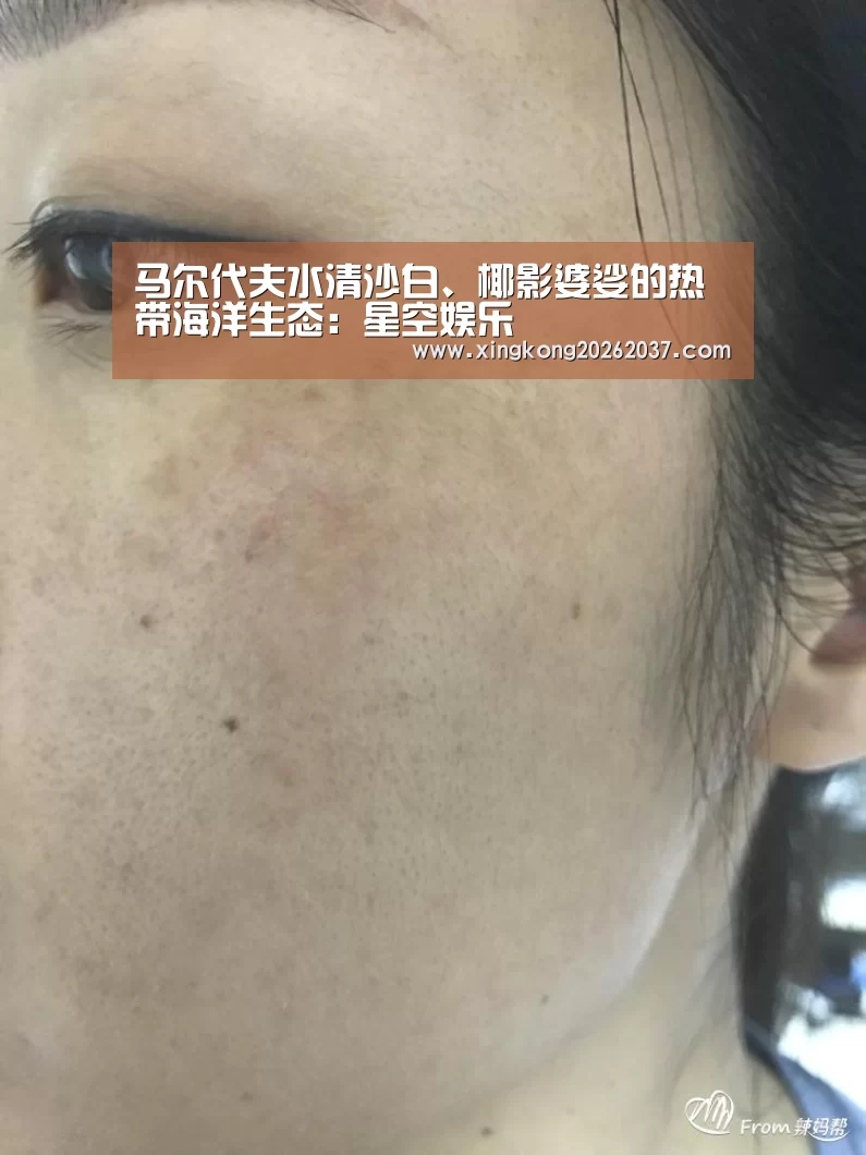 马尔代夫水清沙白、椰影婆娑的热带海洋生态:星空娱乐(图2) 星空登录